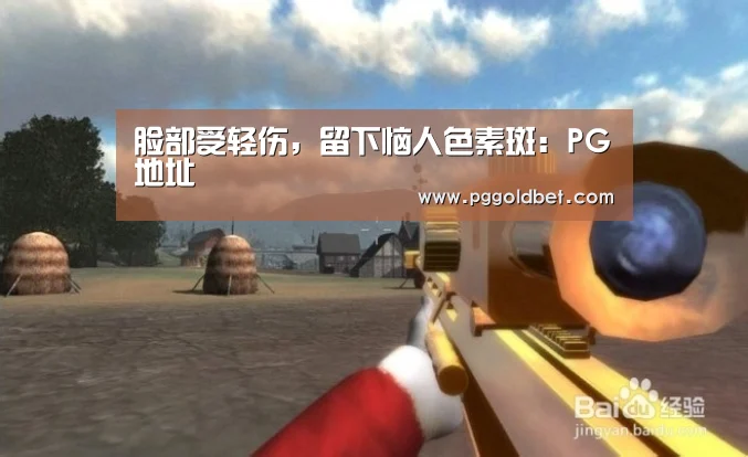 脸部受轻伤,留下恼人色素斑:PG地址(图2) PG中心